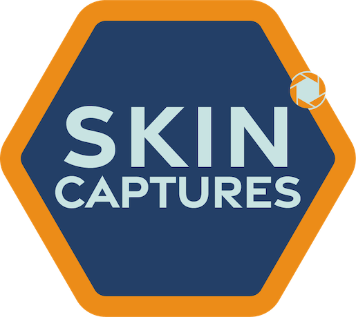 SkinCaptures